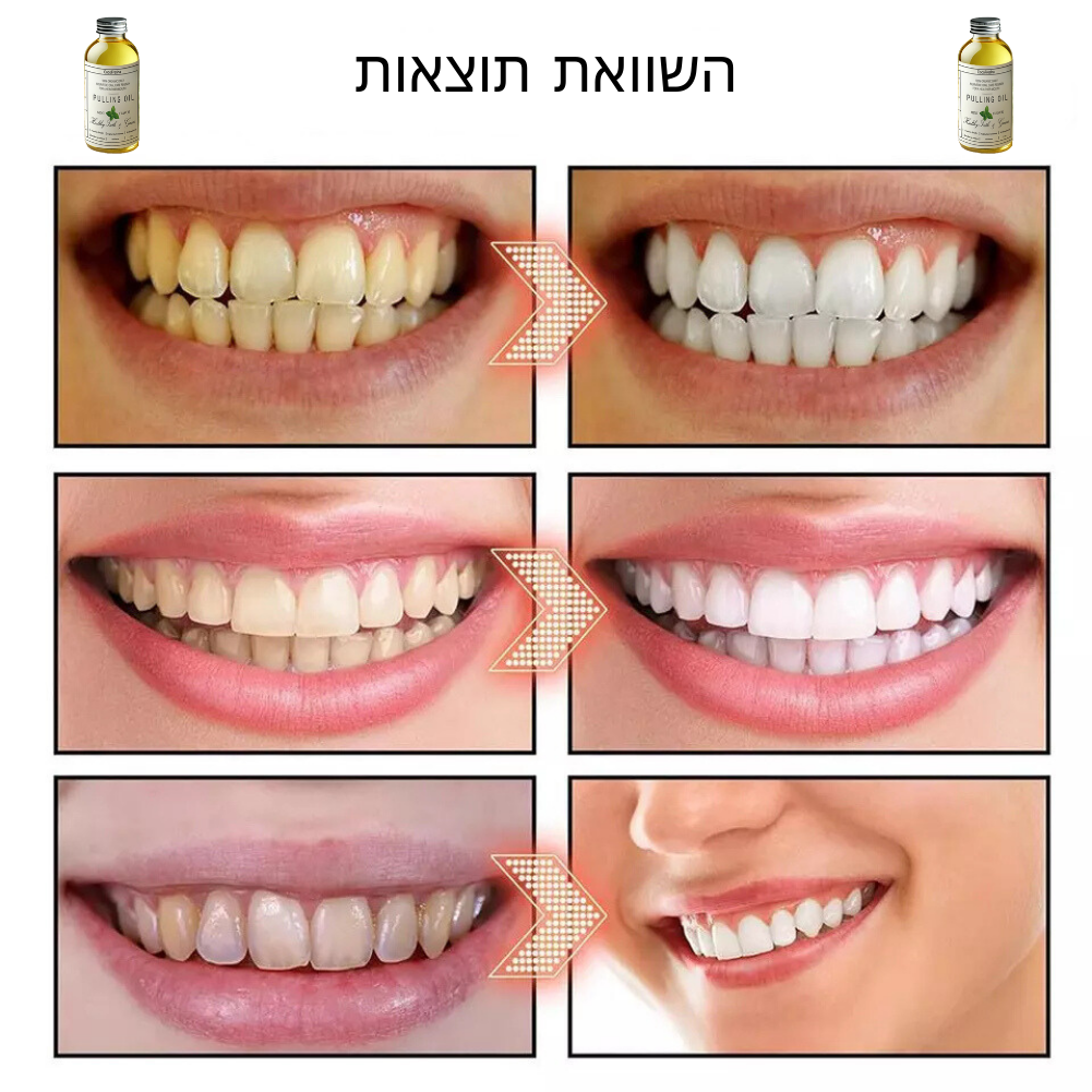 Coco Oil Pulling™ - שמן משיכה עוצמתי אורגני עם קוקוס ונענע